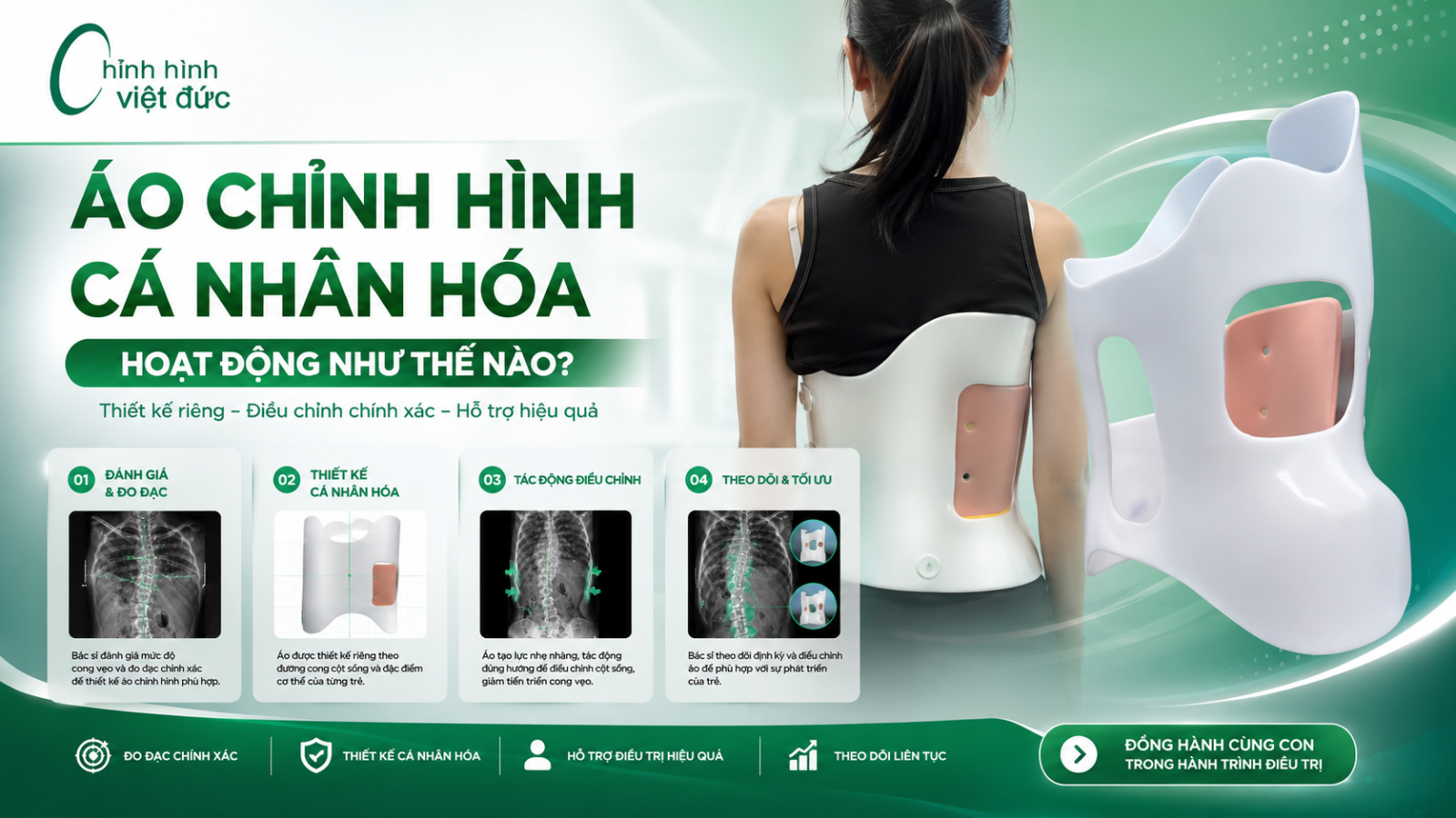 áo chỉnh hình cá nhân hóa