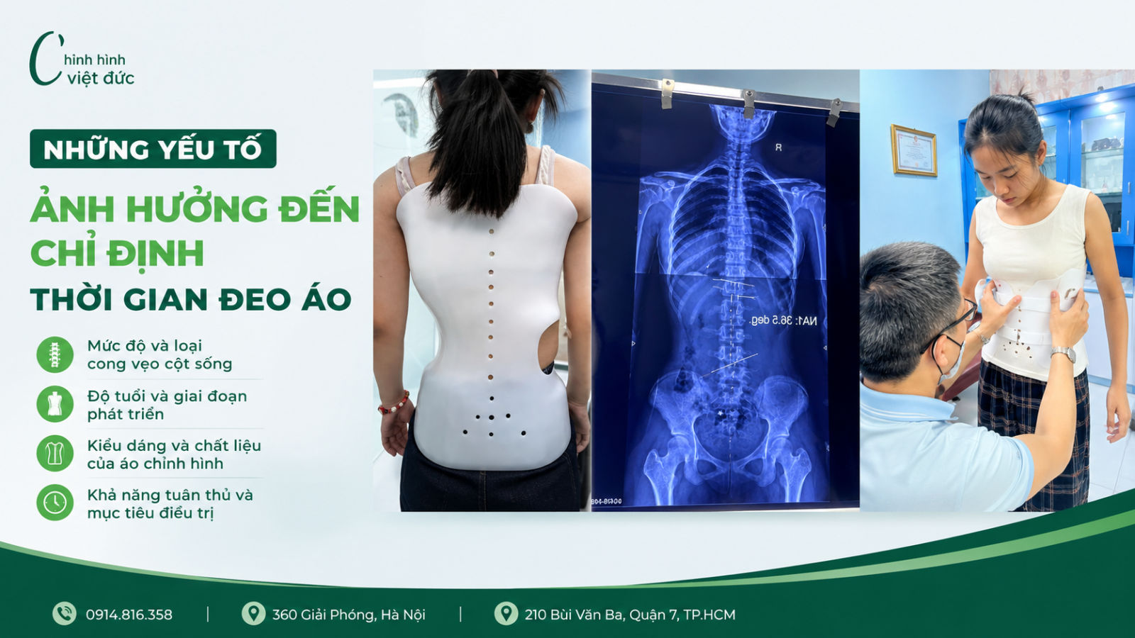 Đeo áo chỉnh hình bao nhiêu giờ mỗi ngày