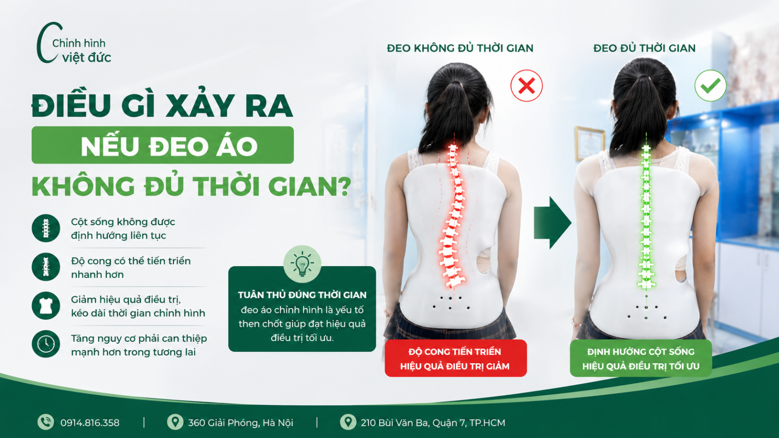 Đeo áo chỉnh hình bao nhiêu giờ mỗi ngày