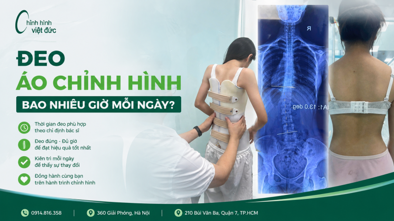 Đeo áo chỉnh hình bao nhiêu giờ mỗi ngày