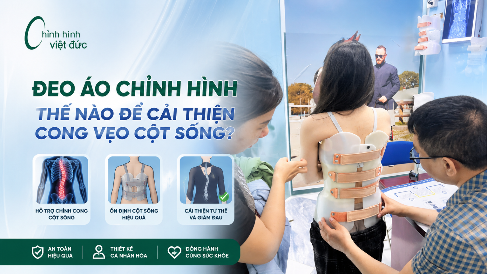 đeo áo chỉnh hình thế nào để cải thiện cong vẹo cột sống 