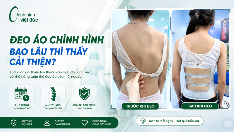 Đeo áo chỉnh hình thế nào để cải thiện cột sống