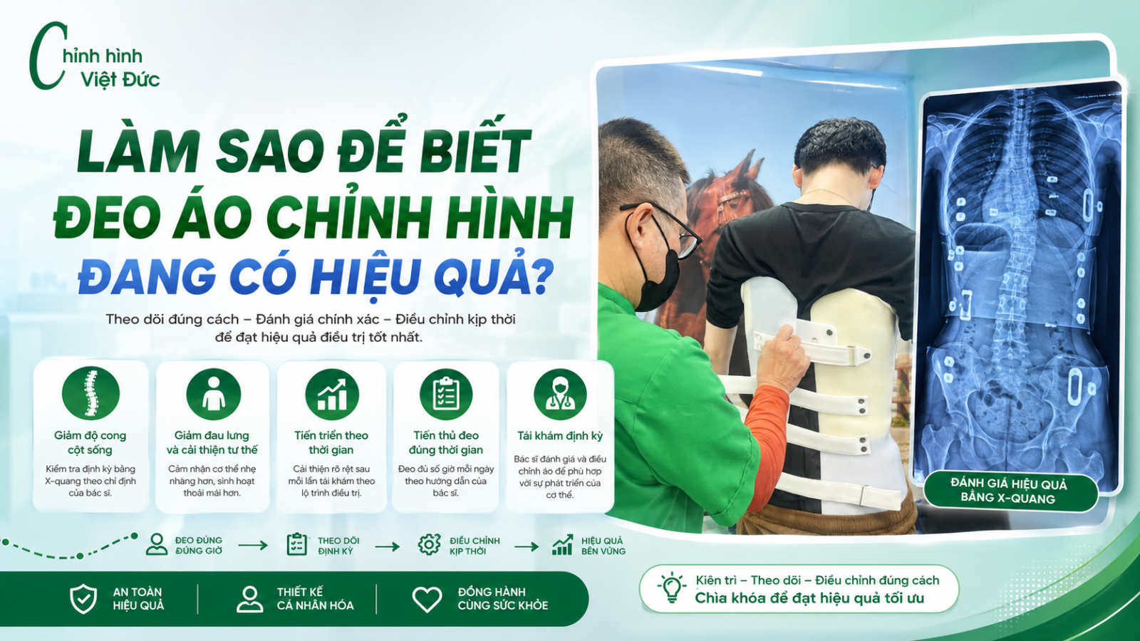 Đeo áo chỉnh hình thế nào để cải thiện