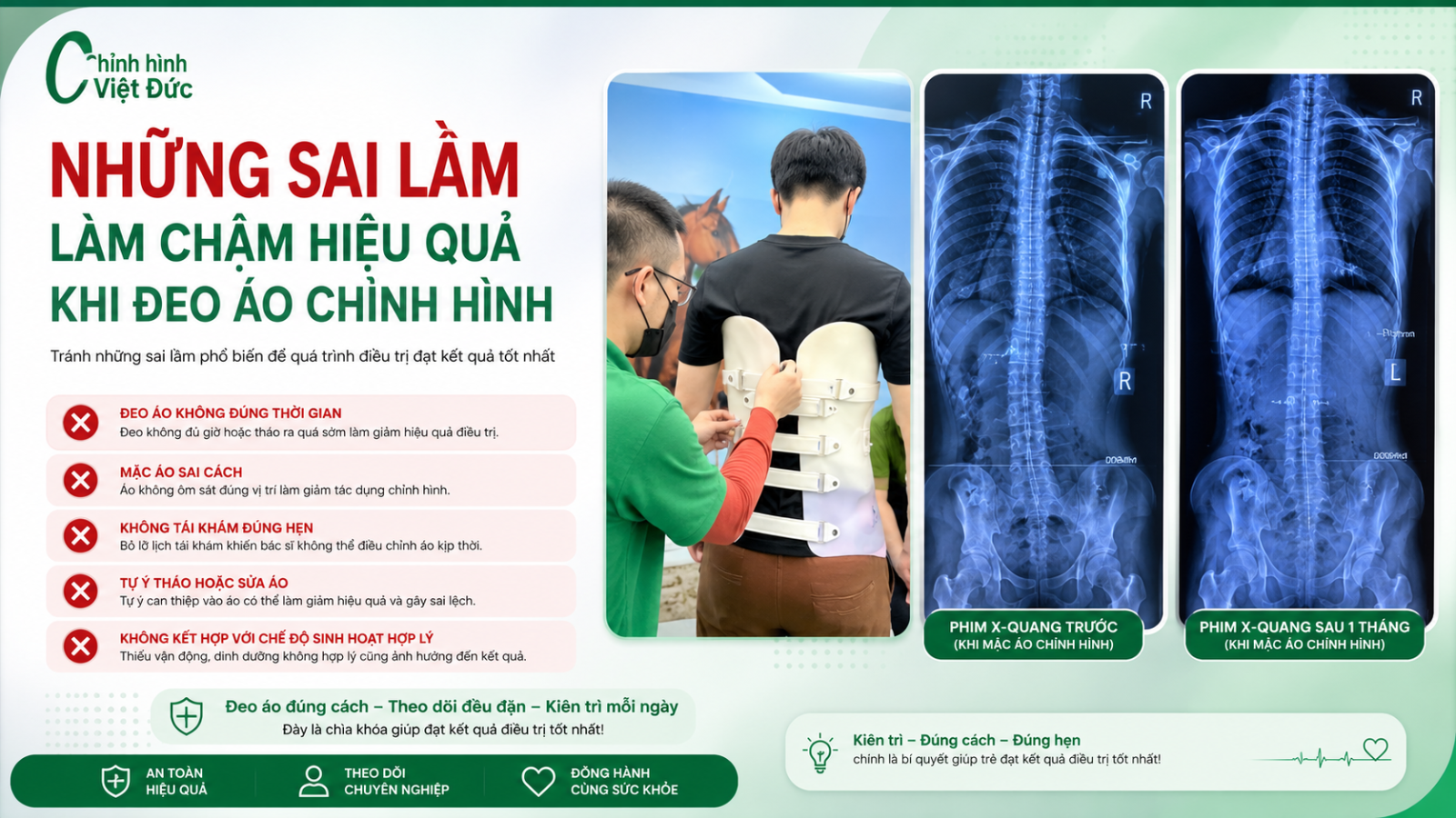 Đeo áo chỉnh hình thế nào để cải thiện