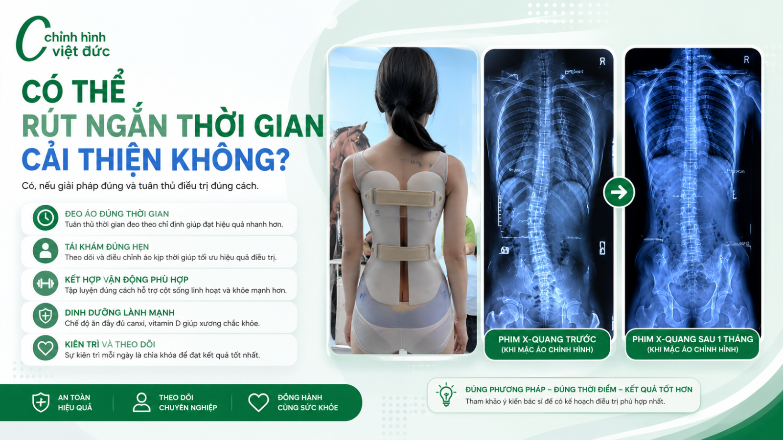 Đeo áo chỉnh hình thế nào để cải thiện