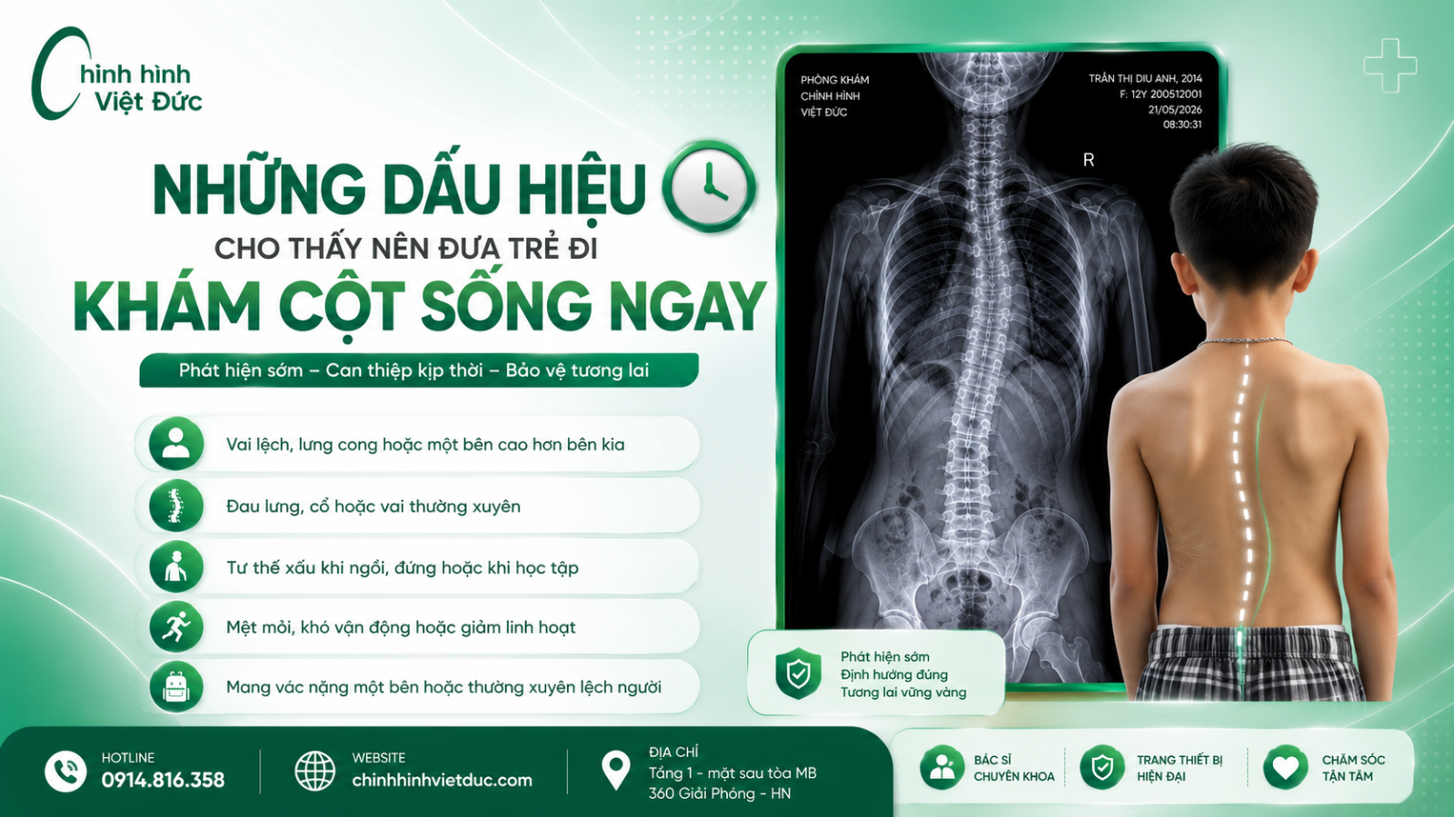 áo chỉnh hình cong vẹo cột sống