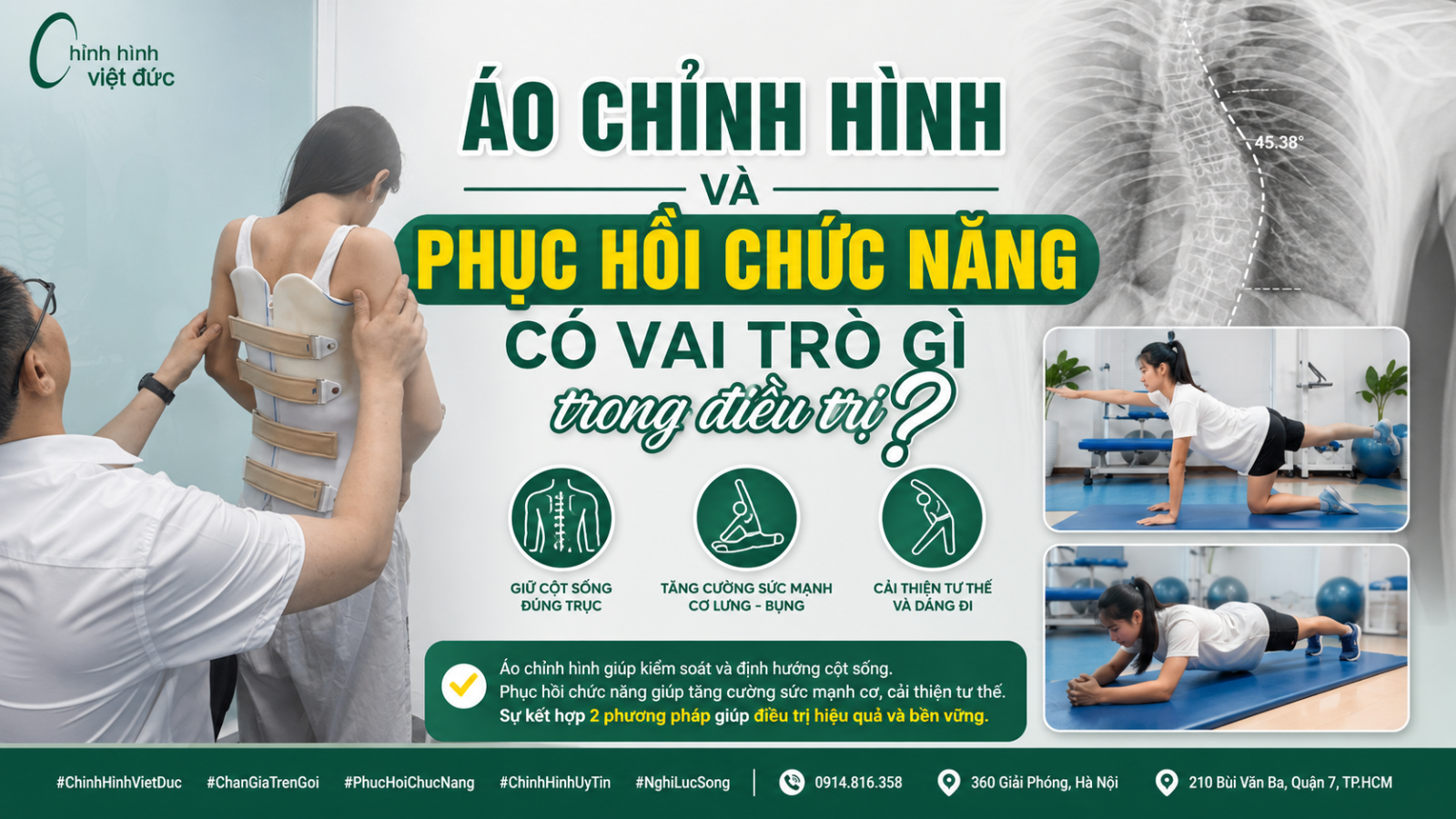 Mặc áo chỉnh hình có cần tập phục hồi chức năng không