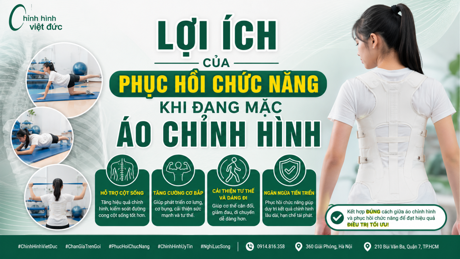 Mặc áo chỉnh hình có cần tập phục hồi chức năng không