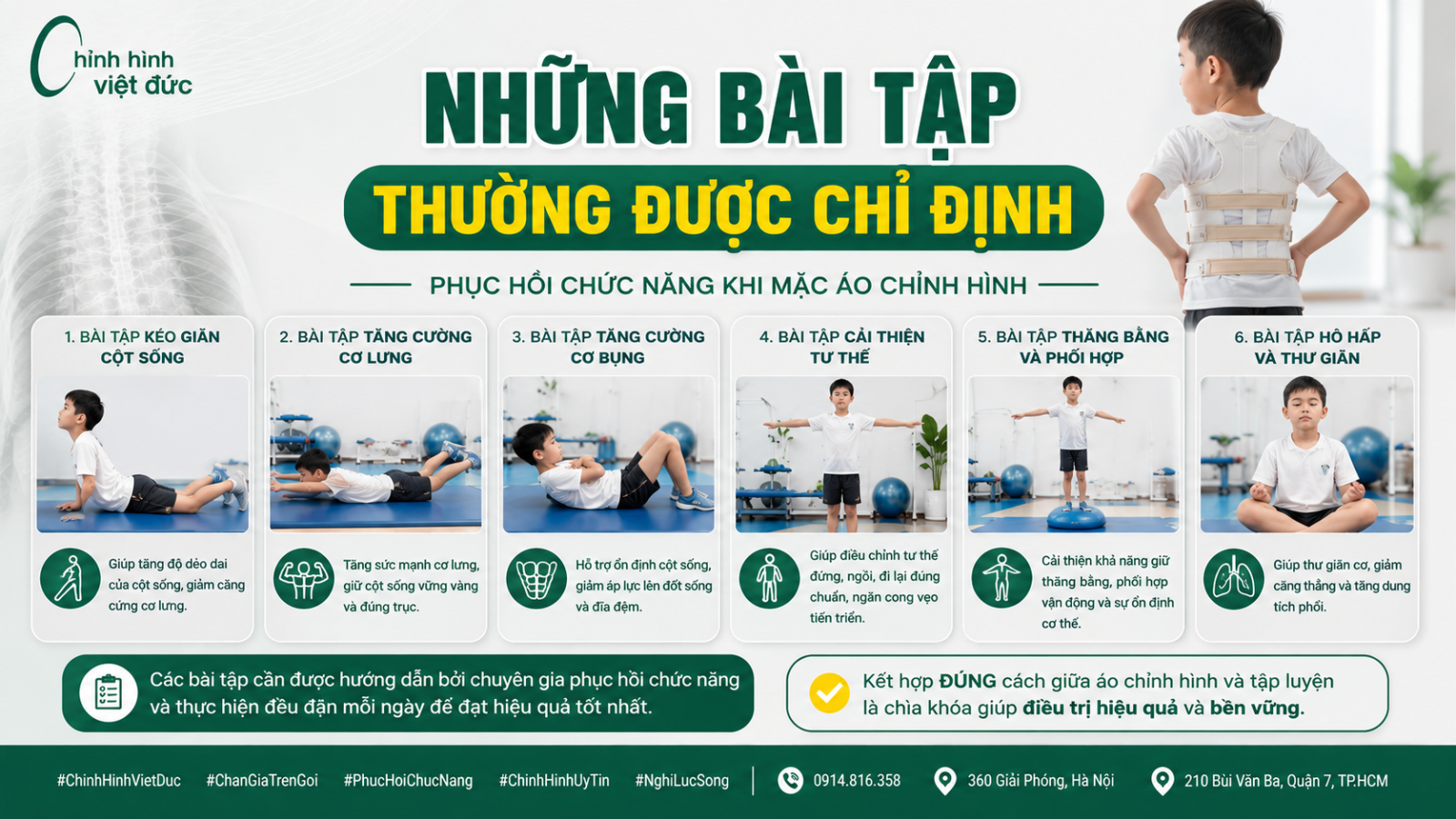 Mặc áo chỉnh hình có cần tập phục hồi chức năng không