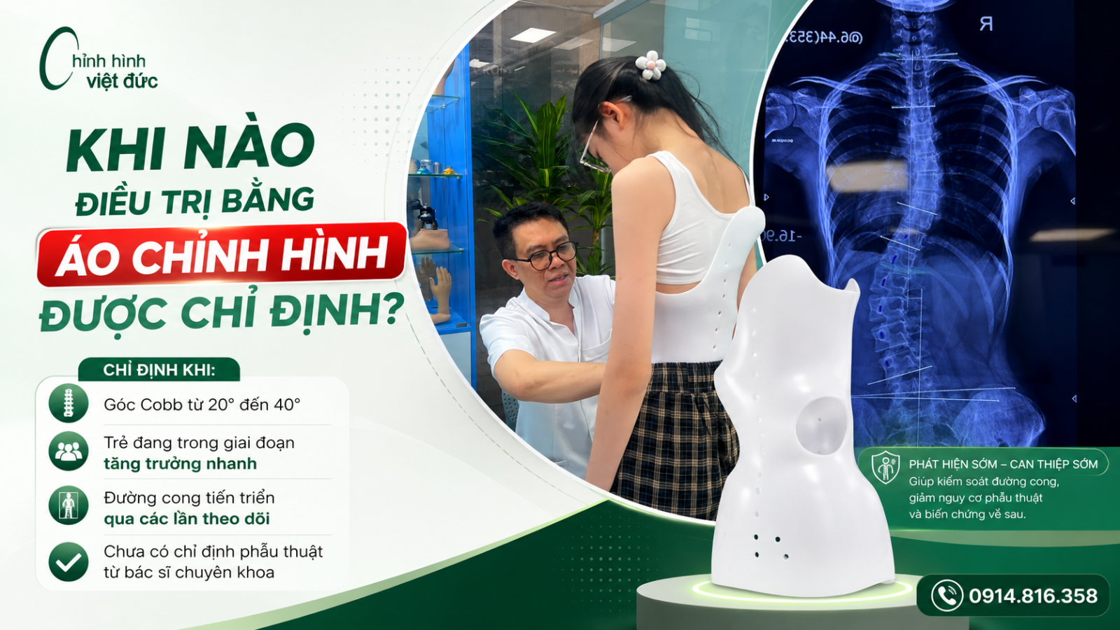 Áo chỉnh hình có thay thế phẫu thuật 