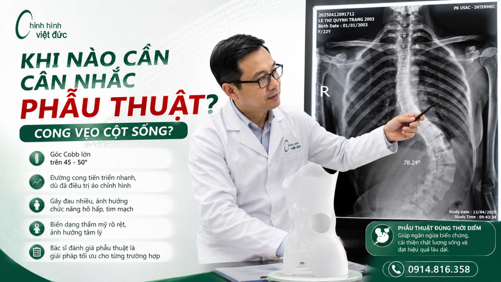 Áo chỉnh hình có thay thế phẫu thuật 