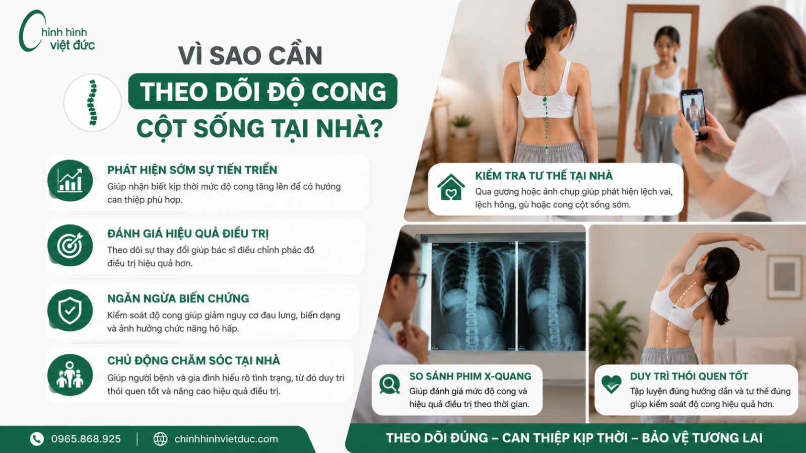 Cách theo dõi độ cong cột sống tại nhà
