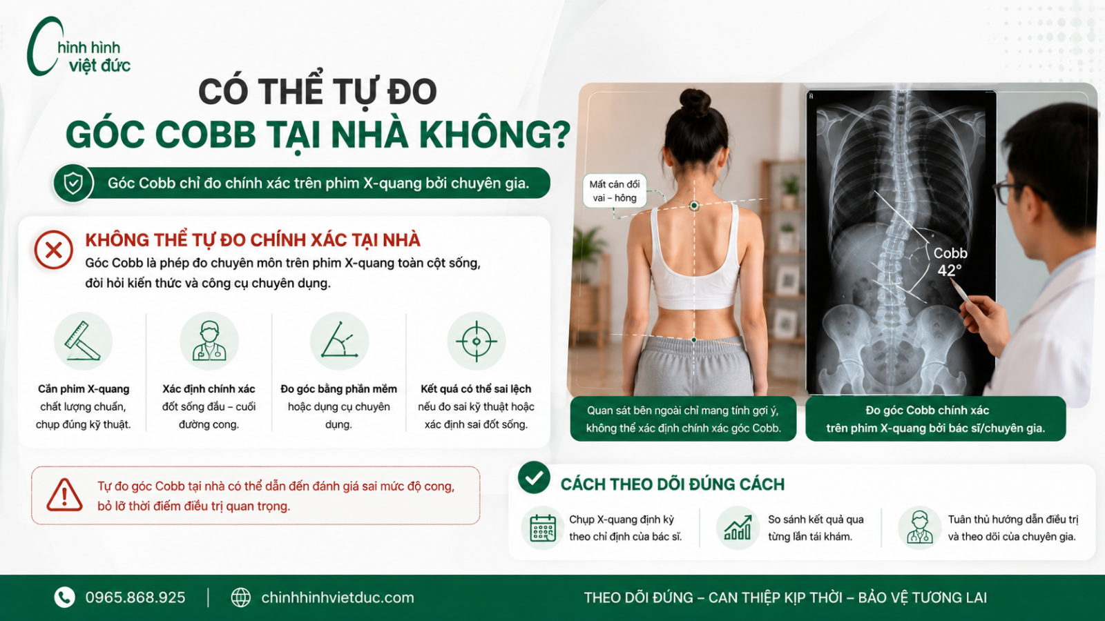 Cách theo dõi độ cong cột sống tại nhà