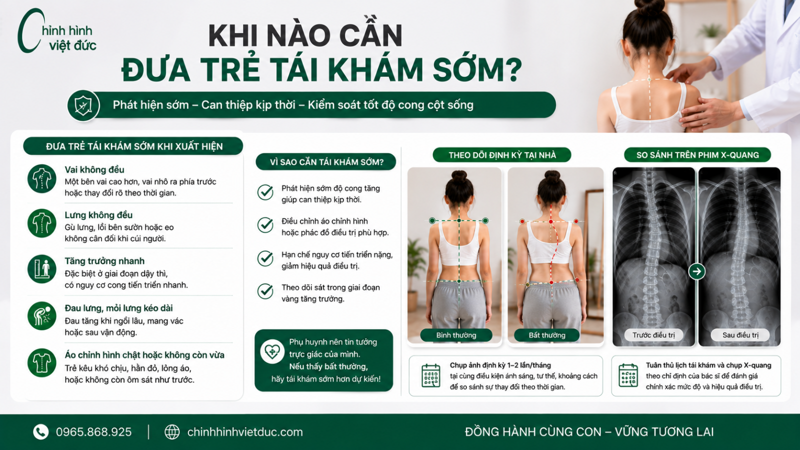 Cách theo dõi độ cong cột sống tại nhà