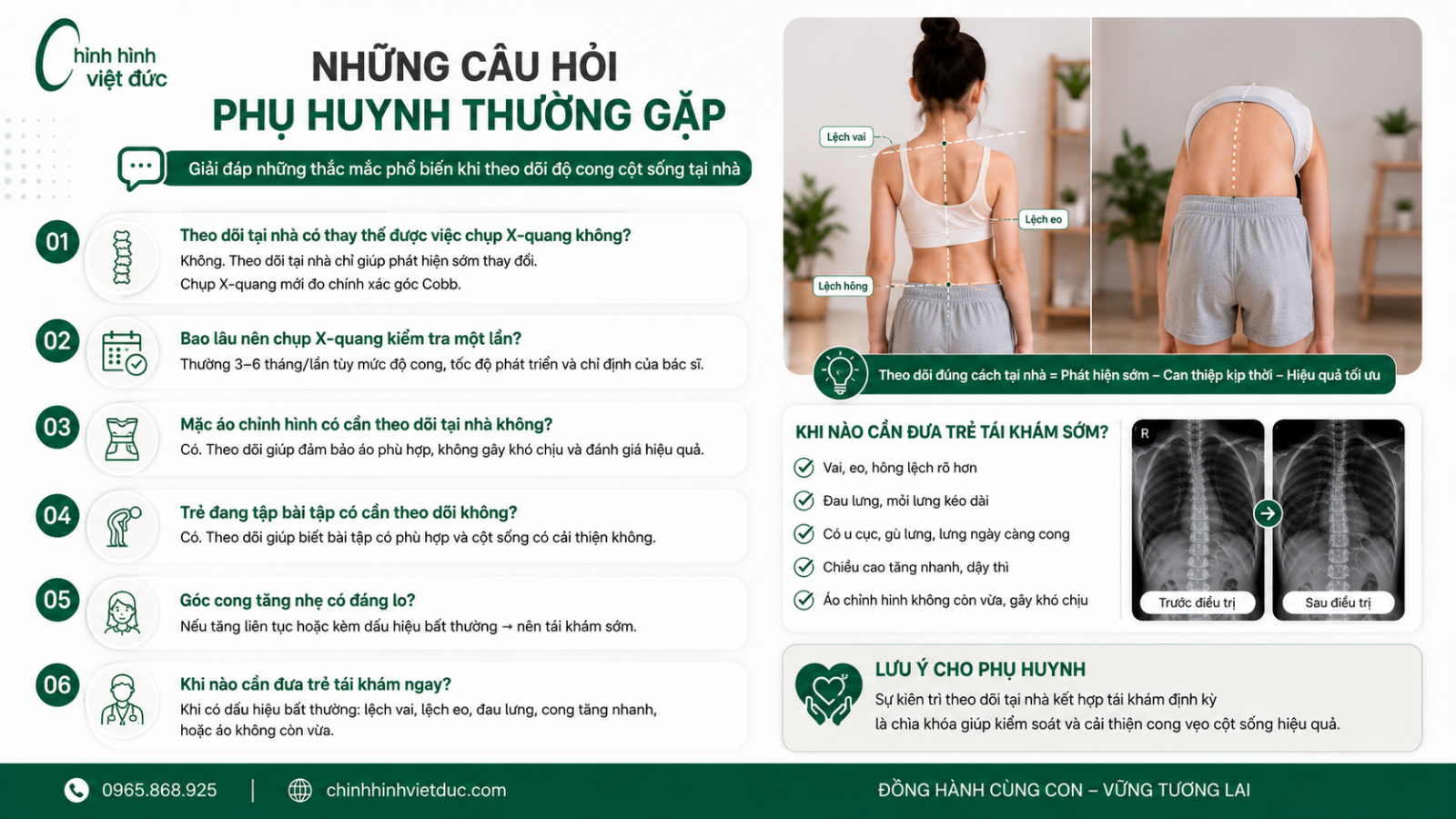Cách theo dõi độ cong cột sống tại nhà