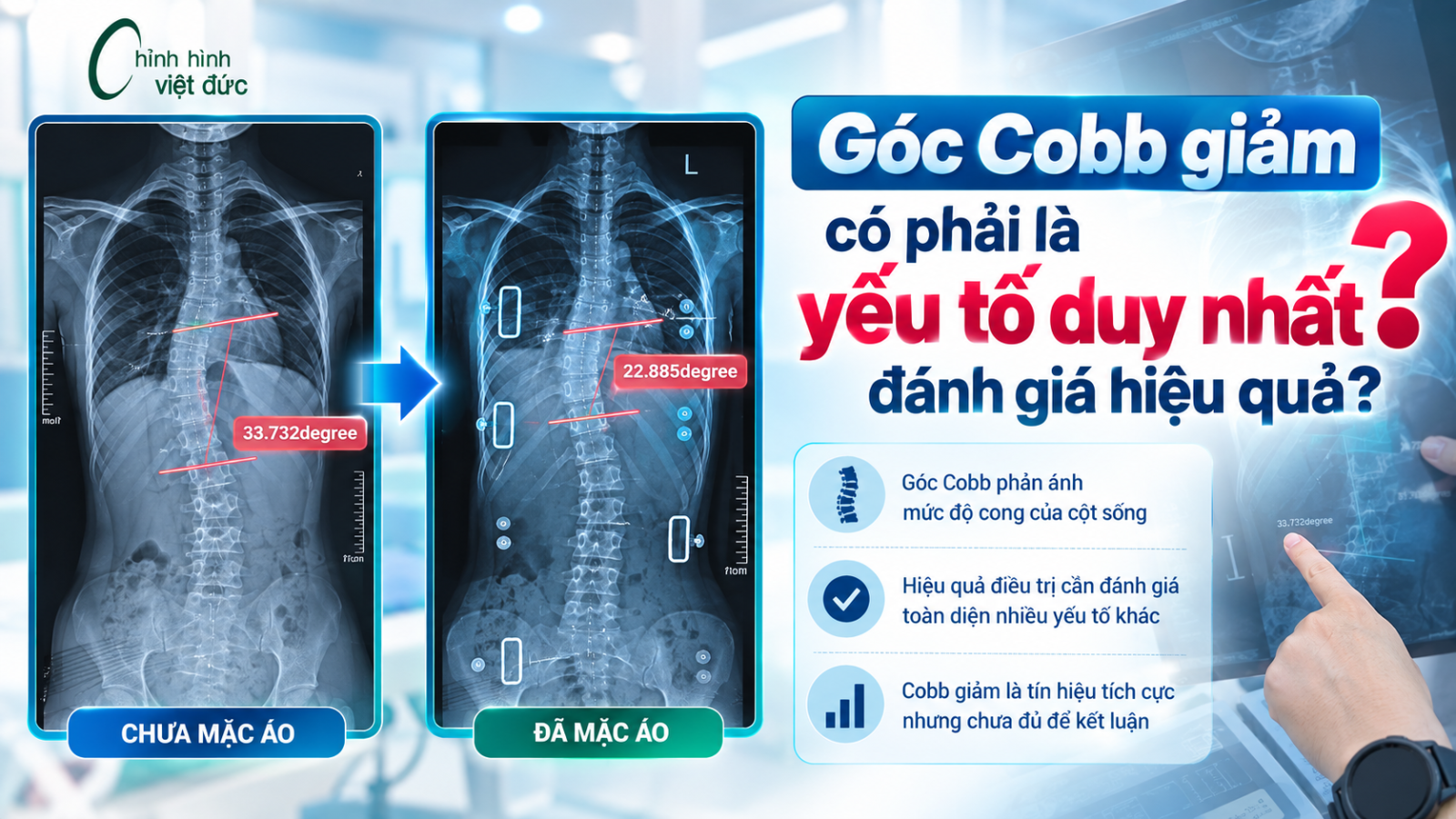 góc cobb giảm