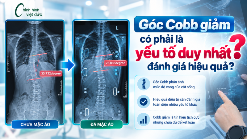 góc cobb giảm