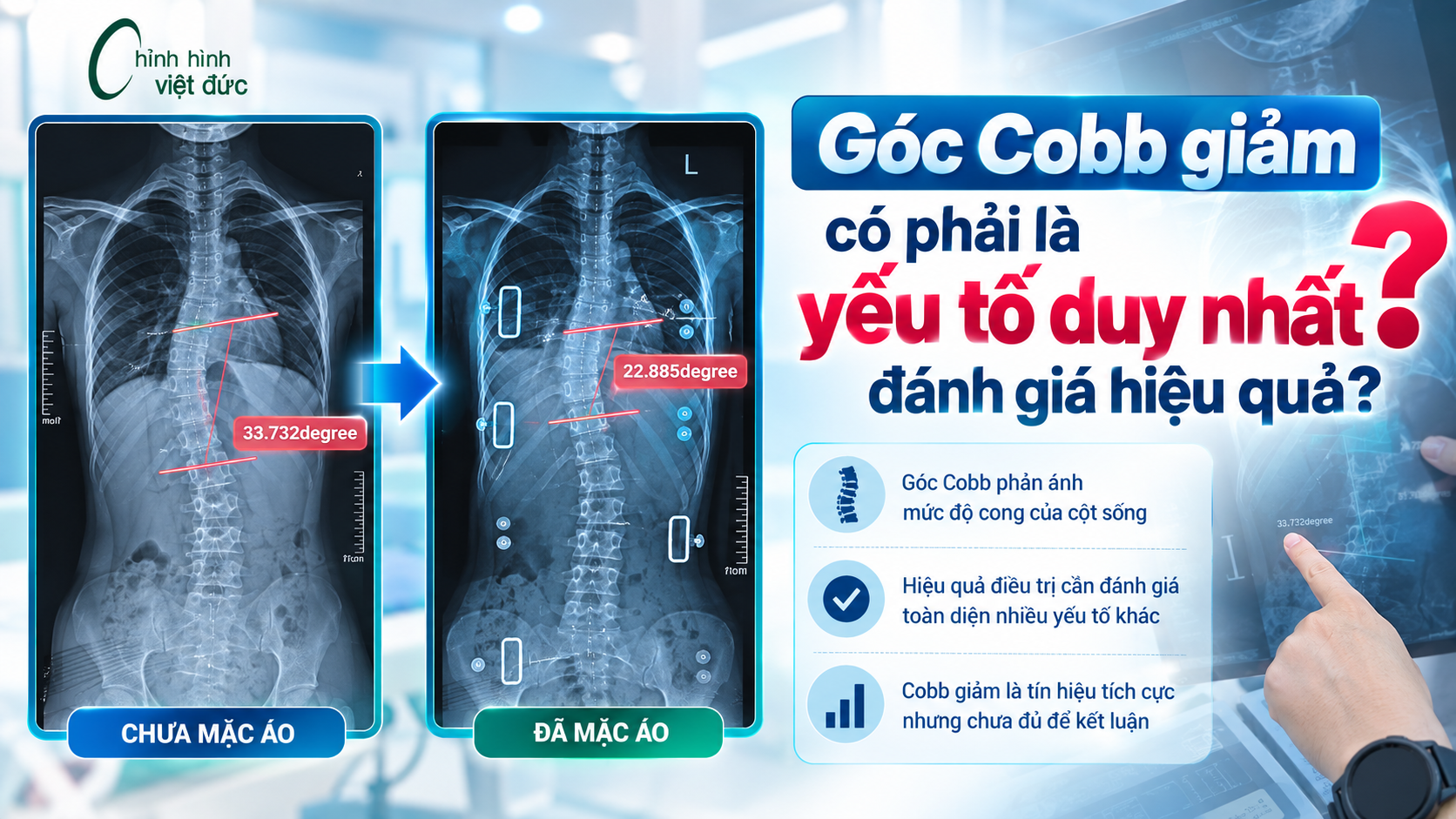 góc cobb giảm