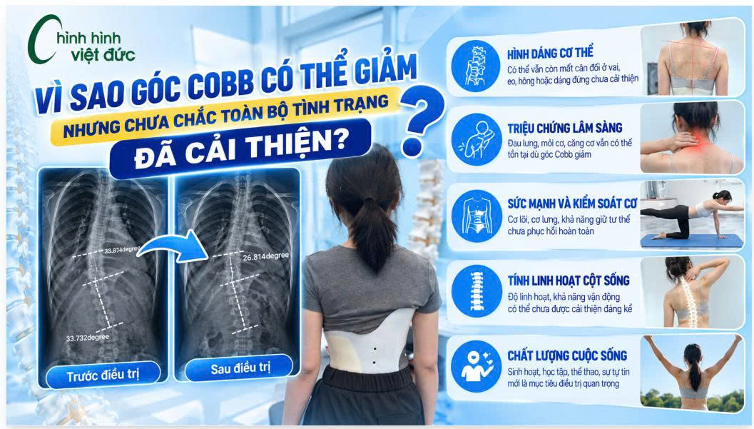góc cobb