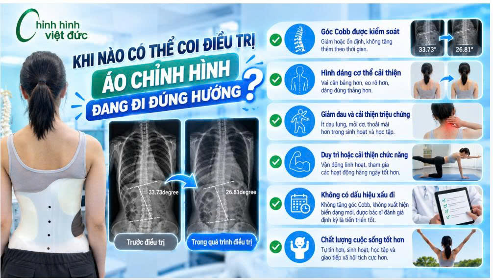 Góc Cobb giảm có phải là yếu tố duy nhất đánh giá hiệu quả?