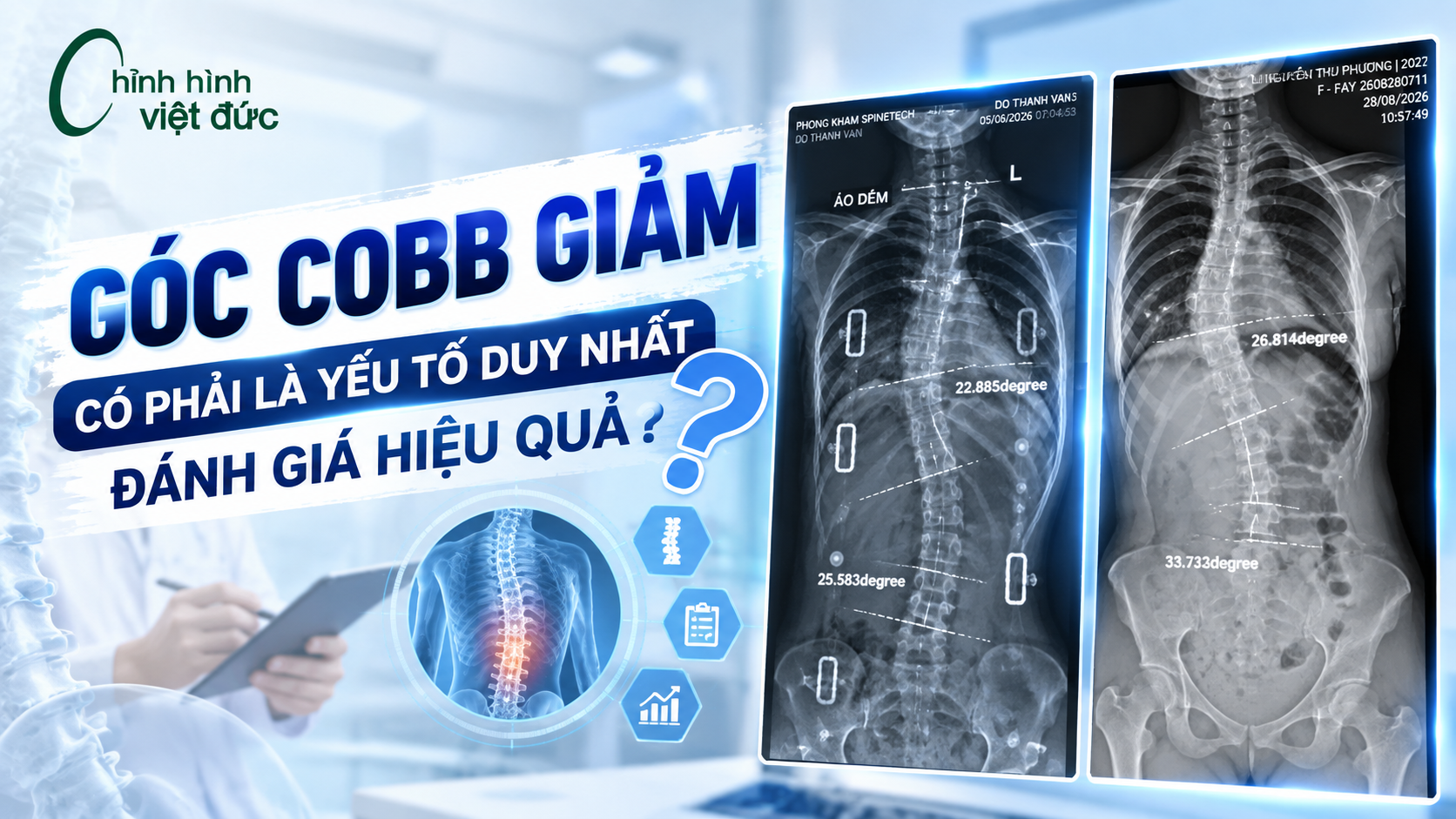 Góc Cobb giảm có phải là yếu tố duy nhất đánh giá hiệu quả?