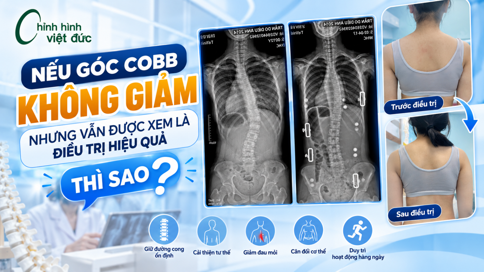 Góc Cobb giảm có phải là yếu tố duy nhất đánh giá hiệu quả?