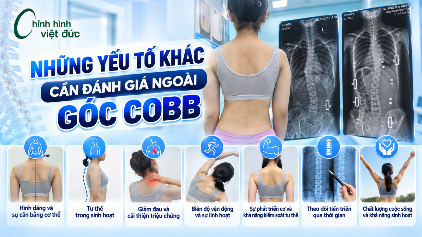 Góc Cobb giảm có phải là yếu tố duy nhất đánh giá hiệu quả?