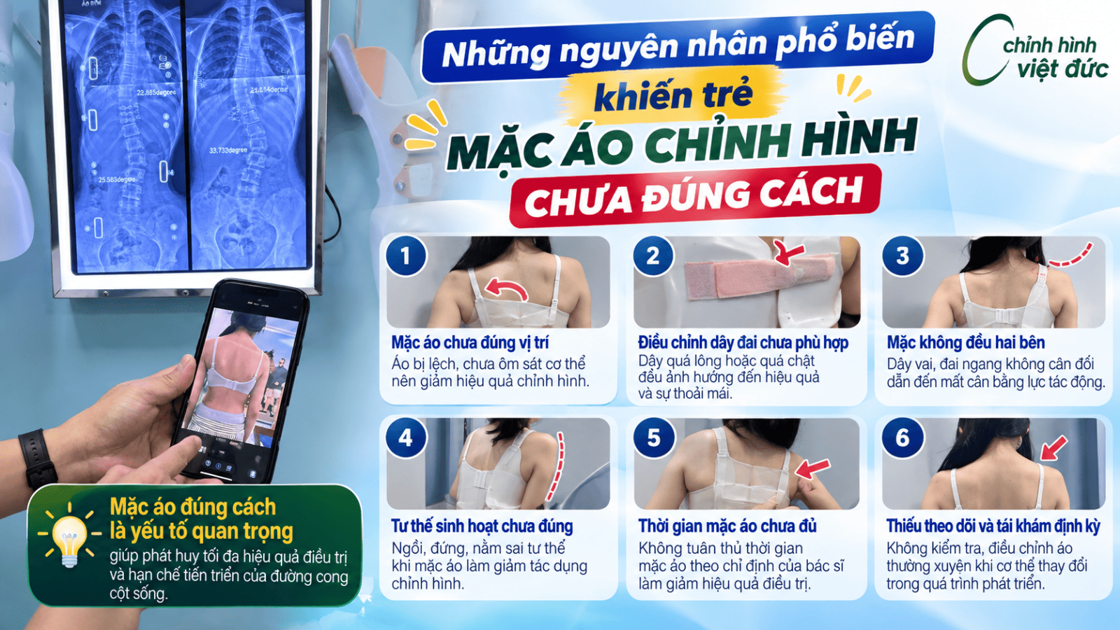 5 dấu hiệu trẻ mặc áo chỉnh hình chưa đúng cách