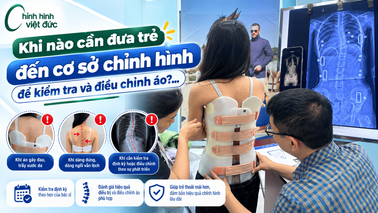 5 đấu hiệu cho thấy trẻ mặc áo chỉnh hình chưa đúng cách