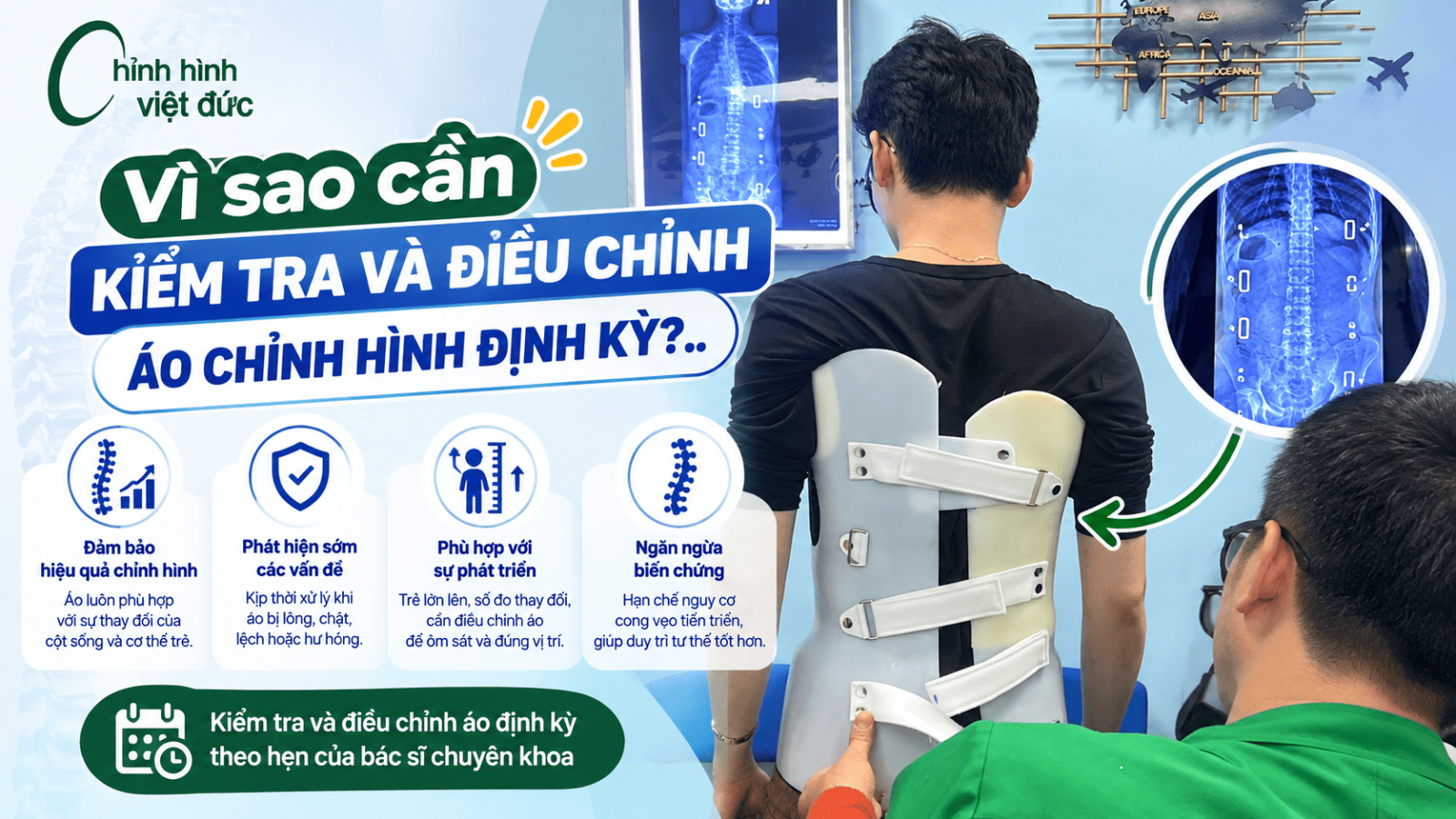 5 đấu hiệu cho thấy trẻ mặc áo chỉnh hình chưa đúng cách