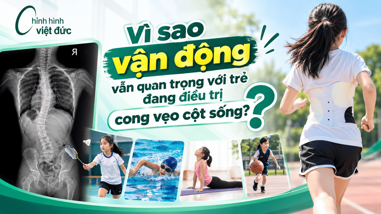 Con có chơi thể thao khi mặc áo chỉnh hình 