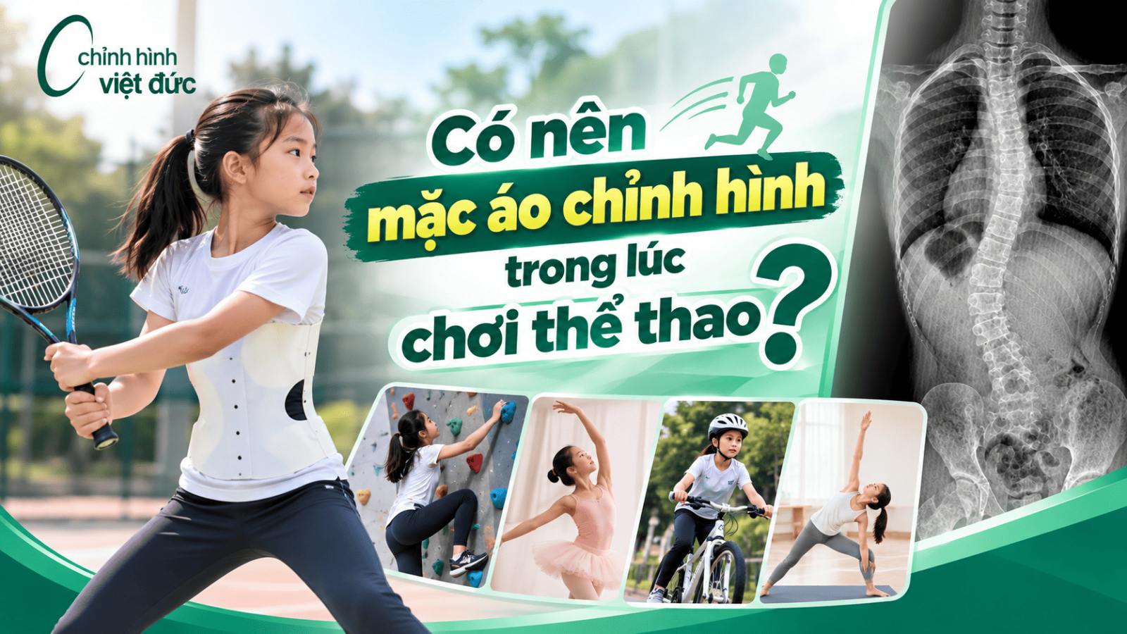Con có chơi thể thao khi mặc áo chỉnh hình 