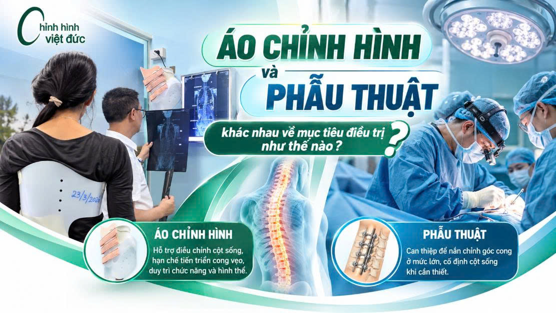 Khi nào phải phẫu thuật cong vẹo cột sống thay vì đeo áo chỉnh hình?