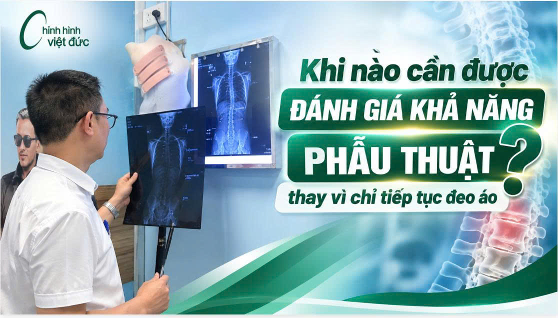 Khi nào phải phẫu thuật cong vẹo cột sống thay vì đeo áo chỉnh hình?