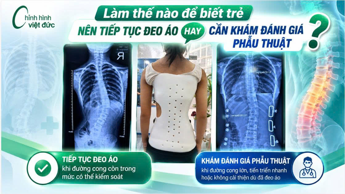 Khi nào phải phẫu thuật thay vì đeo ảo chỉnh hình