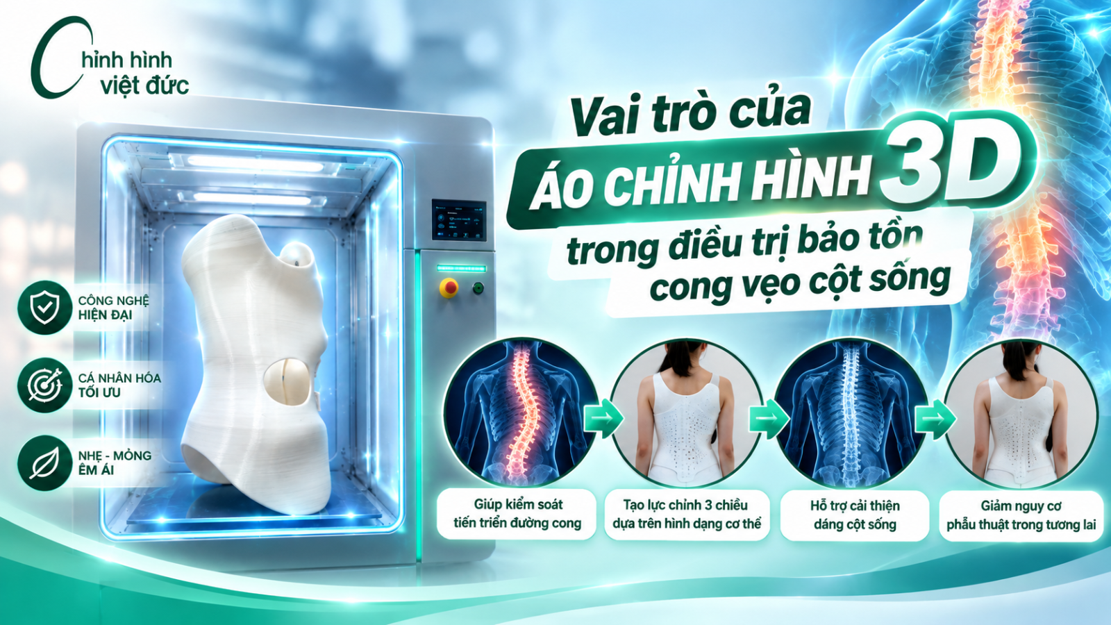 Khi nào phải phẫu thuật thay vì đeo áo chỉnh hình